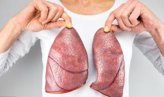 卡介苗是预防什么病